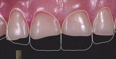 3.gif