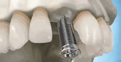 2.gif